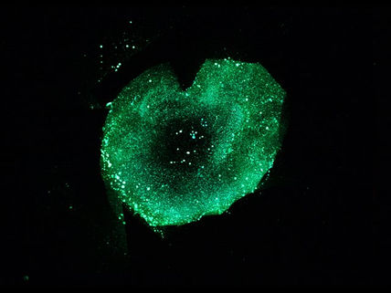 Nebulosa de la...