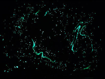 Nebulosa del...