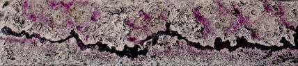 Gemelo 1