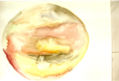 197