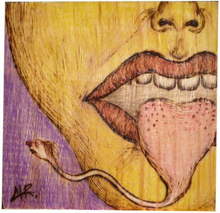 Candidiasis