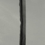 vertebral thumbnail 1