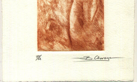 Serie: "Cuerpos sitiados"