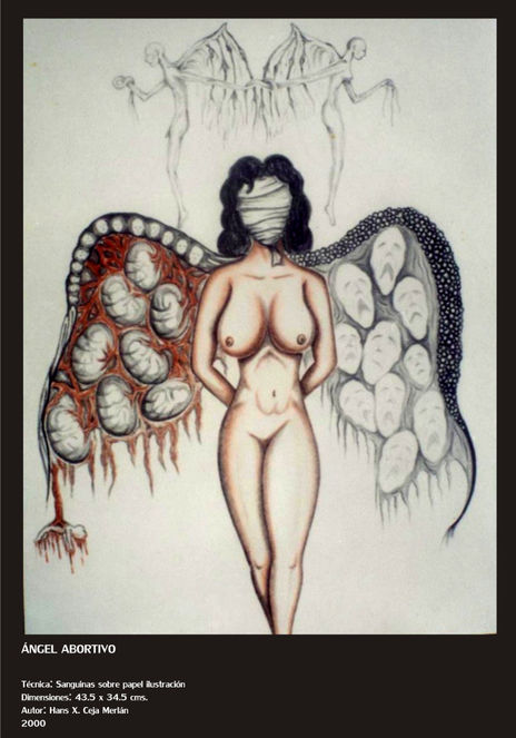 Angel Abortivo