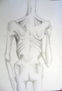 anorexia 2