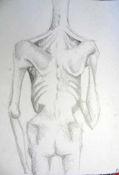 anorexia 2