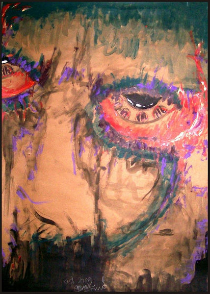Nausea