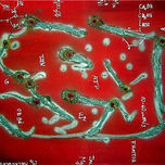 Microbia thumbnail 1