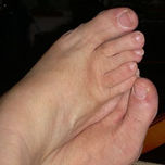 Fotografias thumbnail 1
