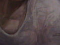detalle