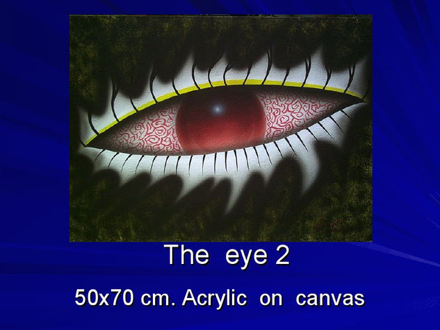 Eye2 