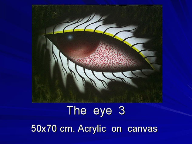 Eye3 