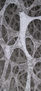 Osteoporosis