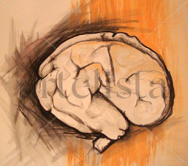 Cerebral