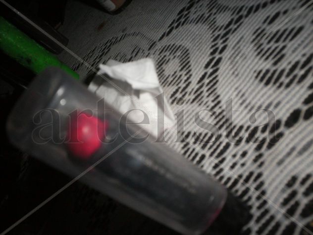 Es normal que mi vejiga sangre?