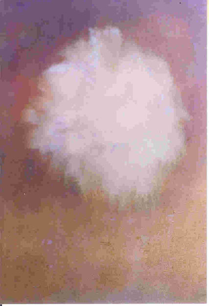 Flor pelusilla