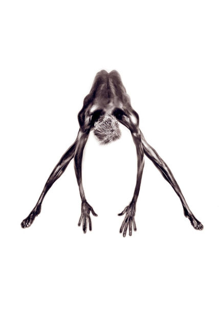 Dismorfofobia 11