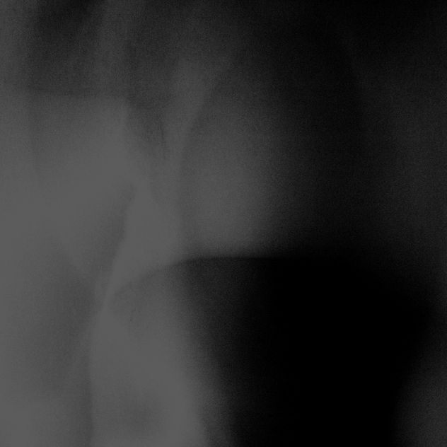 El hombre de la Caverna.