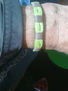 DUALBRACELET 608/2011