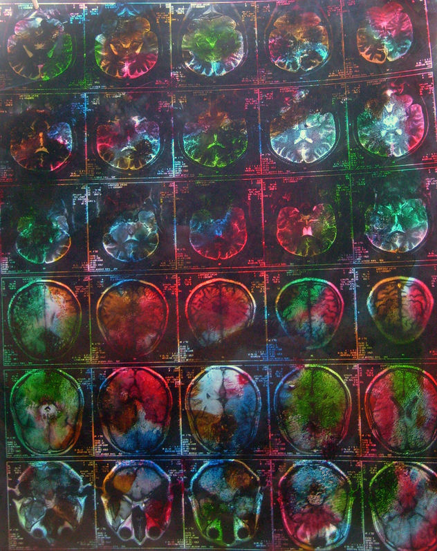 DE LA SERIE: EL COLOR QUE SANA.