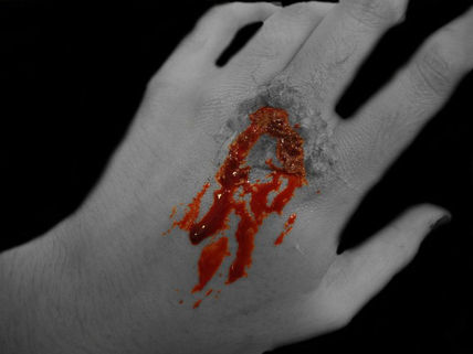 Heridas II