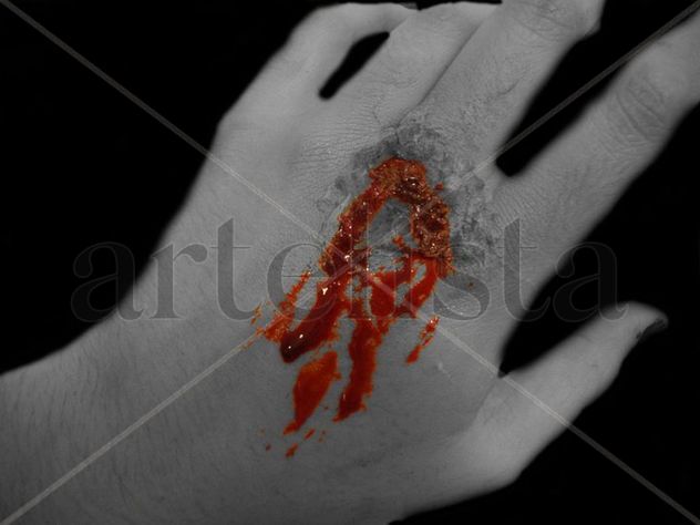 Heridas II