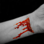 heridas thumbnail 1