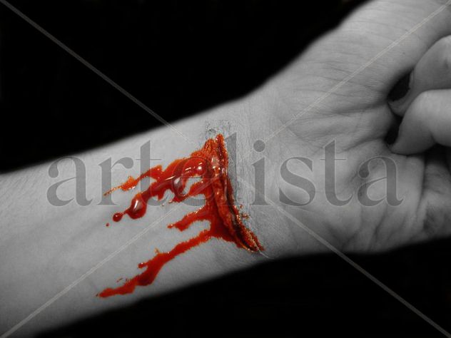 Heridas I
