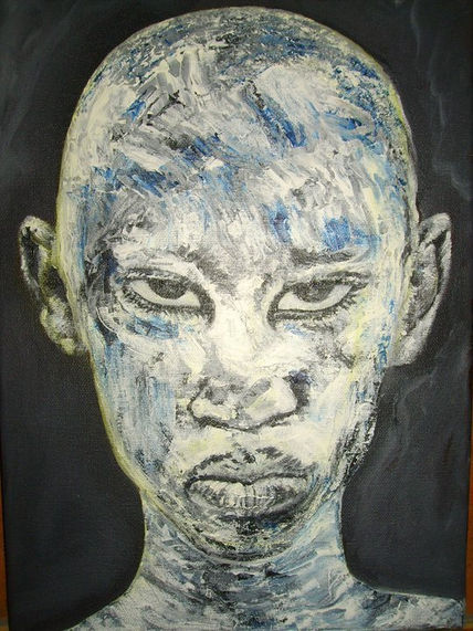 Negro Albino