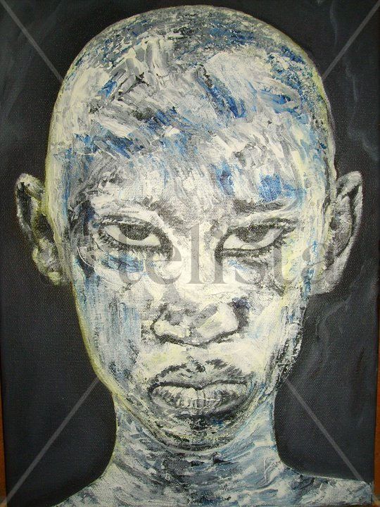 Negro Albino