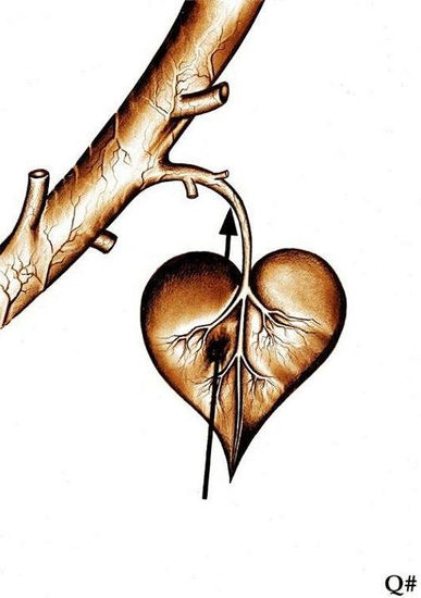 "...EL ES PECIOLO...ELLA, ESPECIAL..." Charcoal