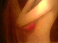AMORFOS