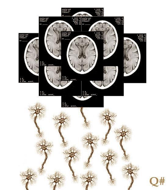 " LA NUBE DE TACS " ( Técnica autocollage de 2 obras Quiméricas a lápiz grafi