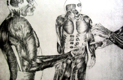 Intento de suicidio