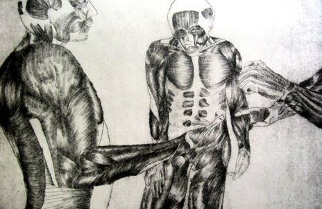 Intento de suicidio