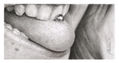 Piercing