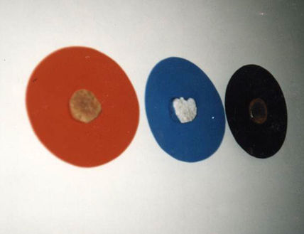 Las edades del corazón