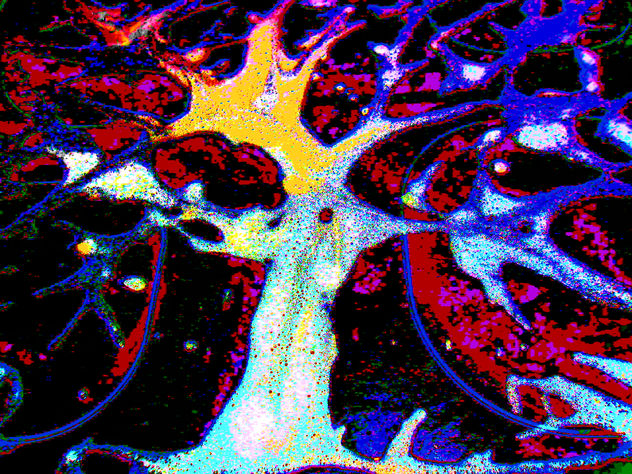 COMPOSICION VLAS.ARBOL VII-