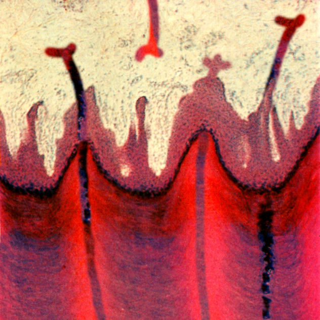 Plants on the Soles of Feet