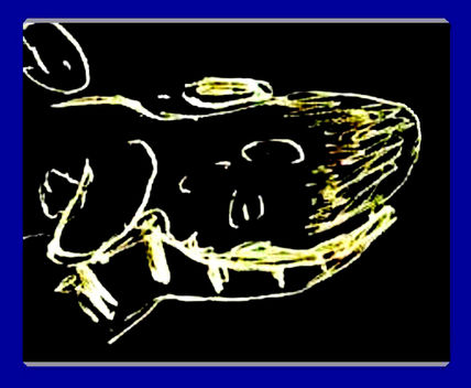 Vinera